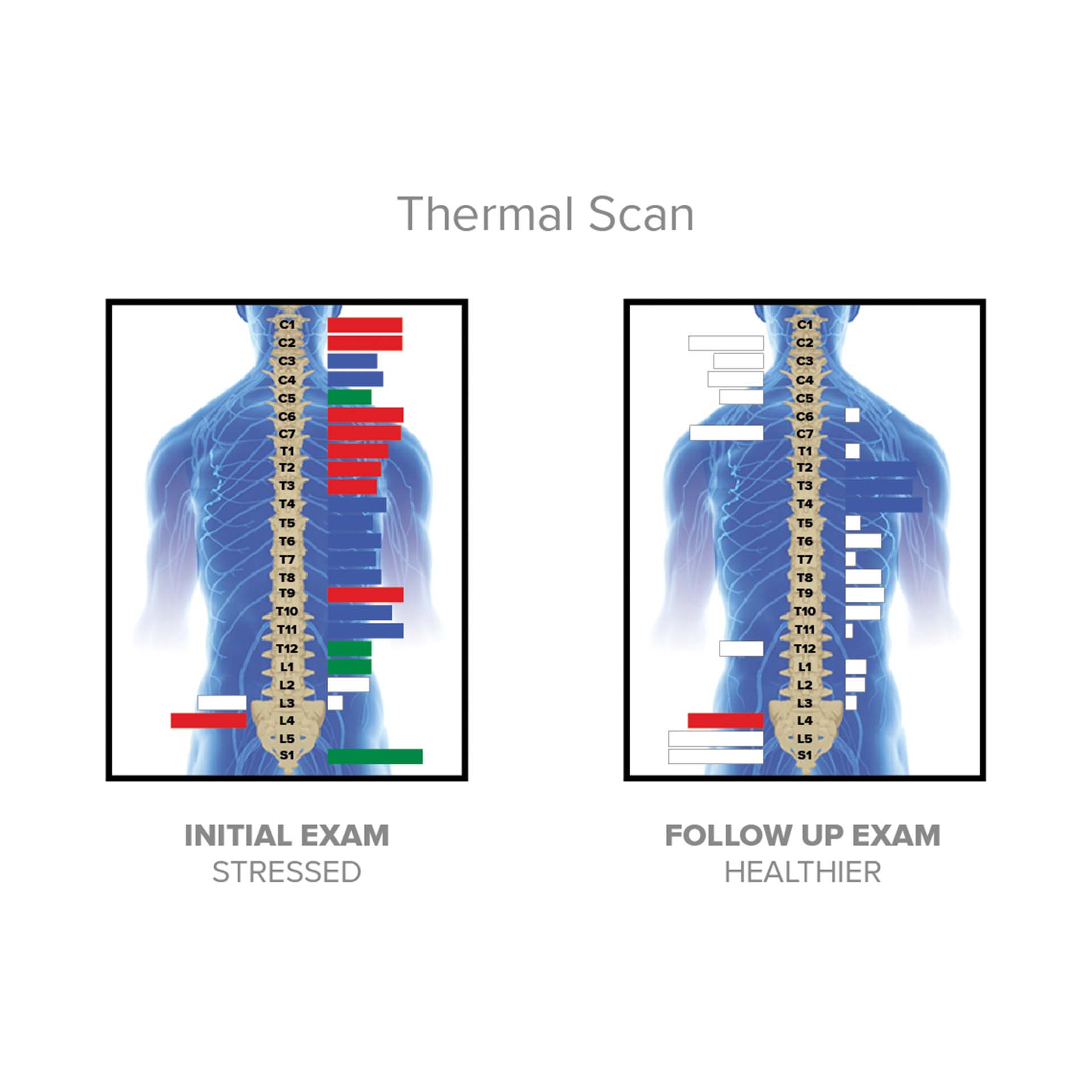 INSiGHT neuroTHERMAL (Thermo)