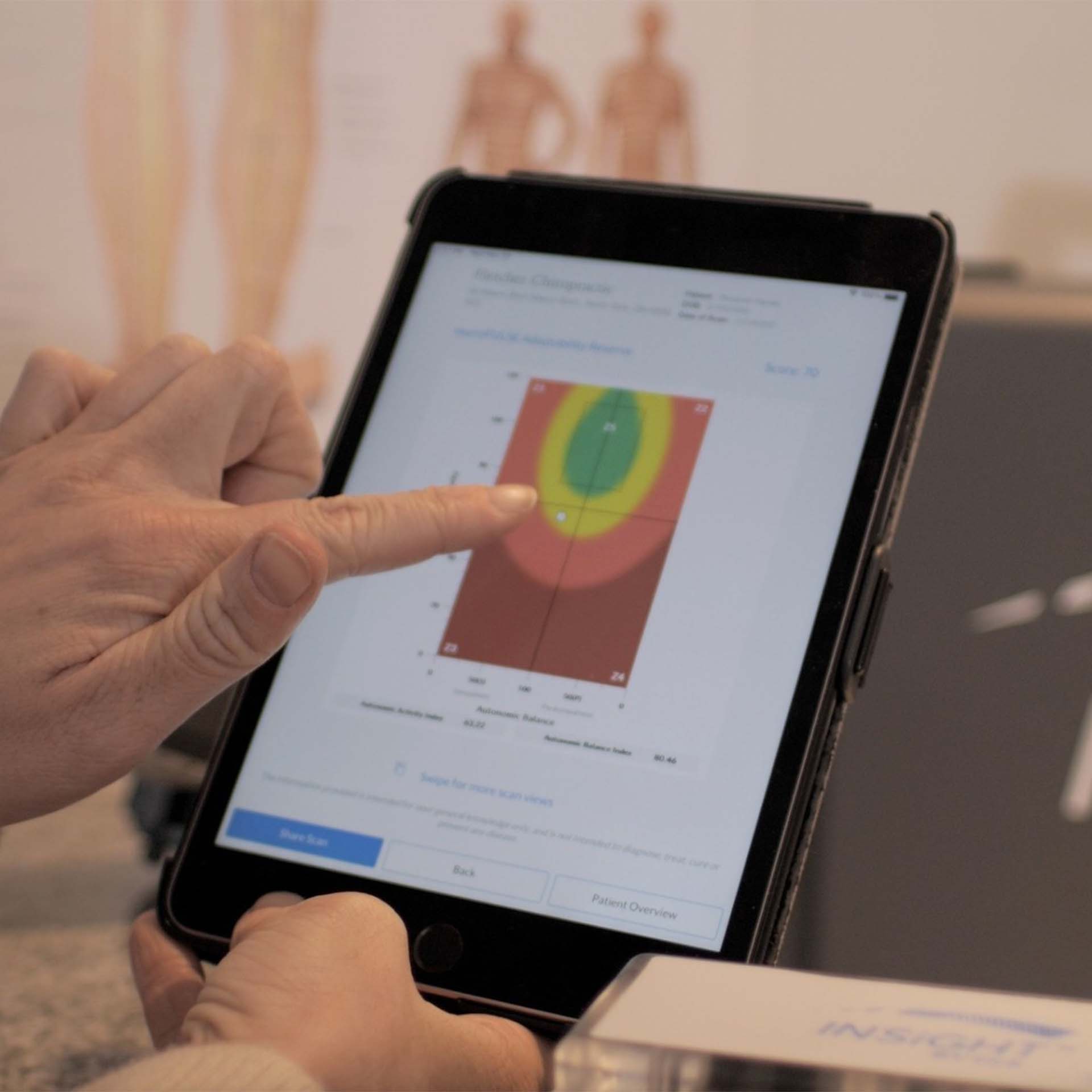 INSiGHT neuroPULSE (HRV)