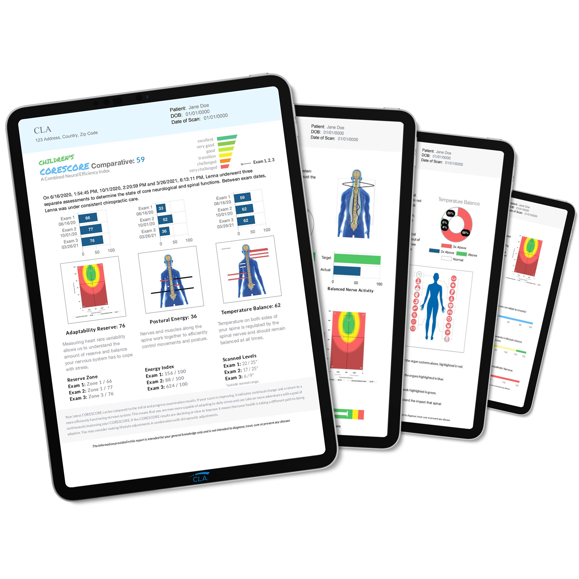 INSiGHT neuroTech (Thermal, EMG, HRV)