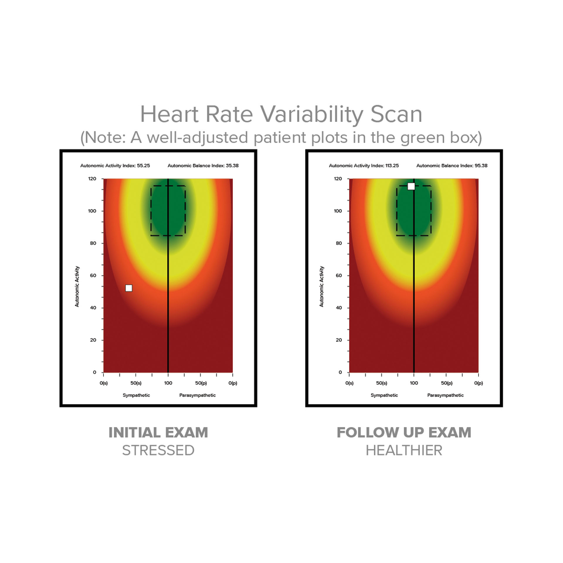 INSiGHT neuroPULSE (HRV)