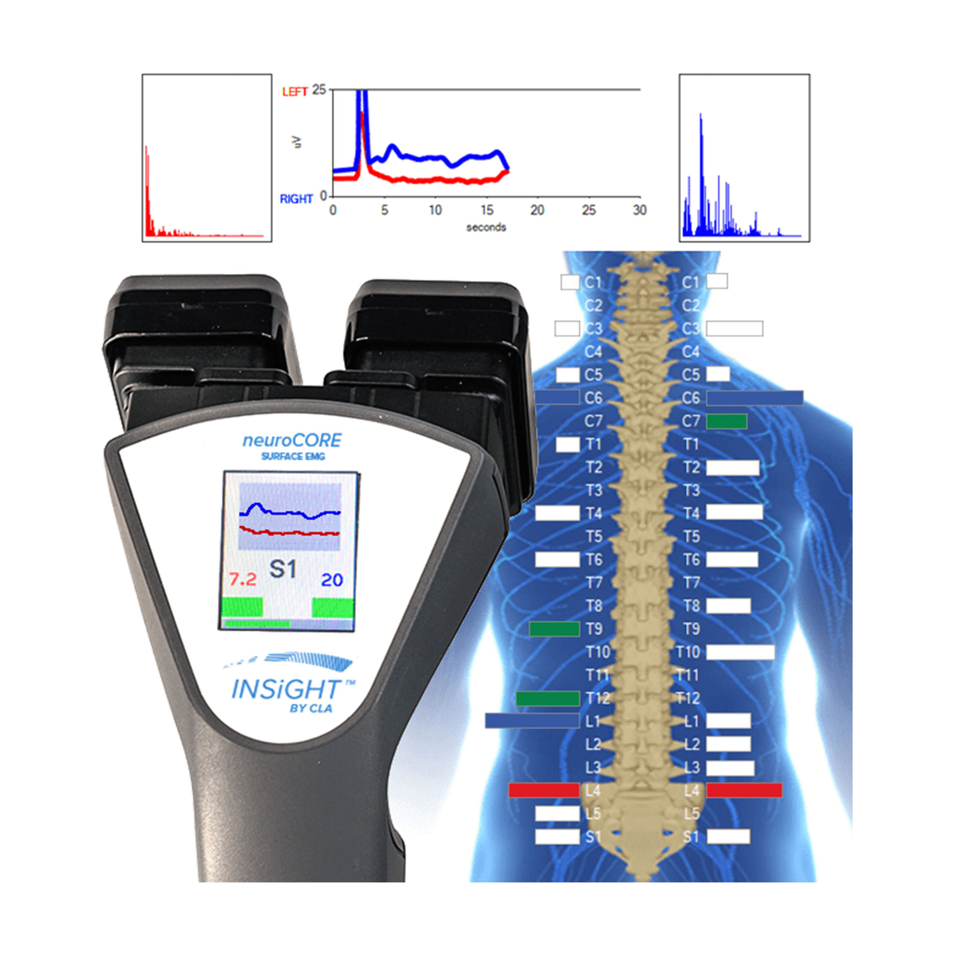 INSiGHT neuroCORE (sEMG)