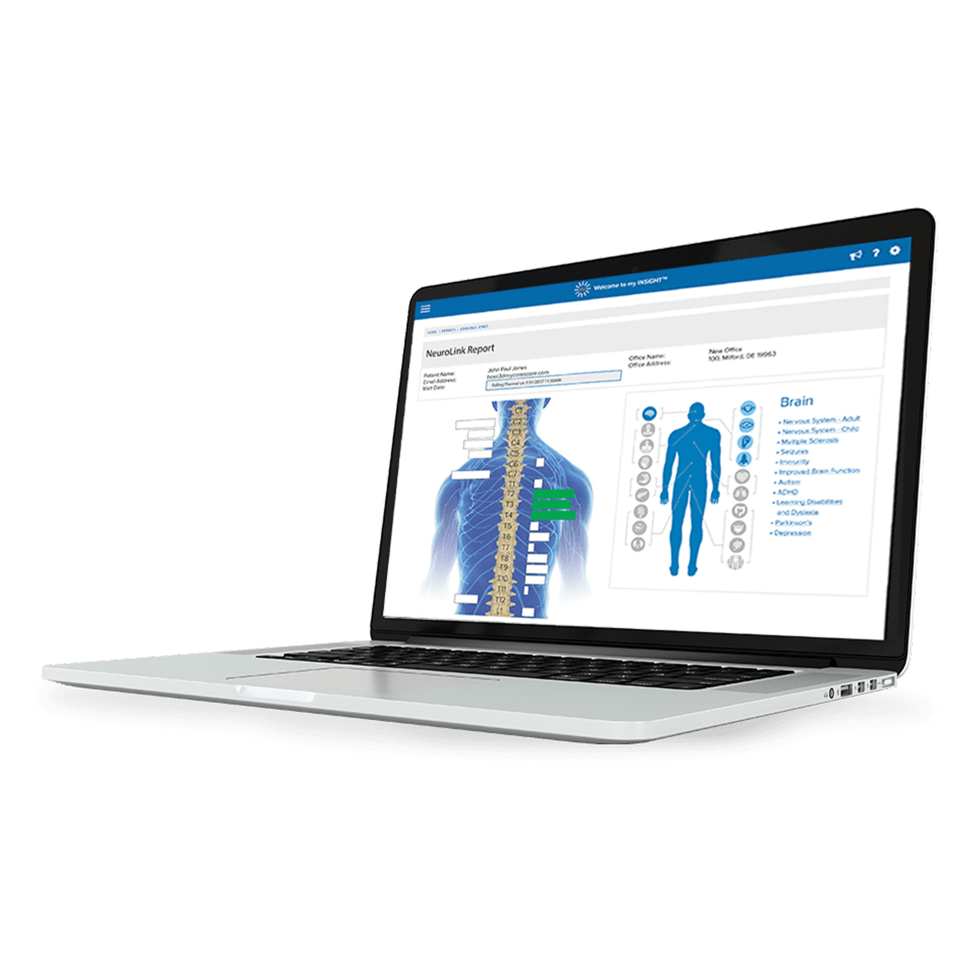 INSiGHT neuroTech (Thermal, EMG, HRV)