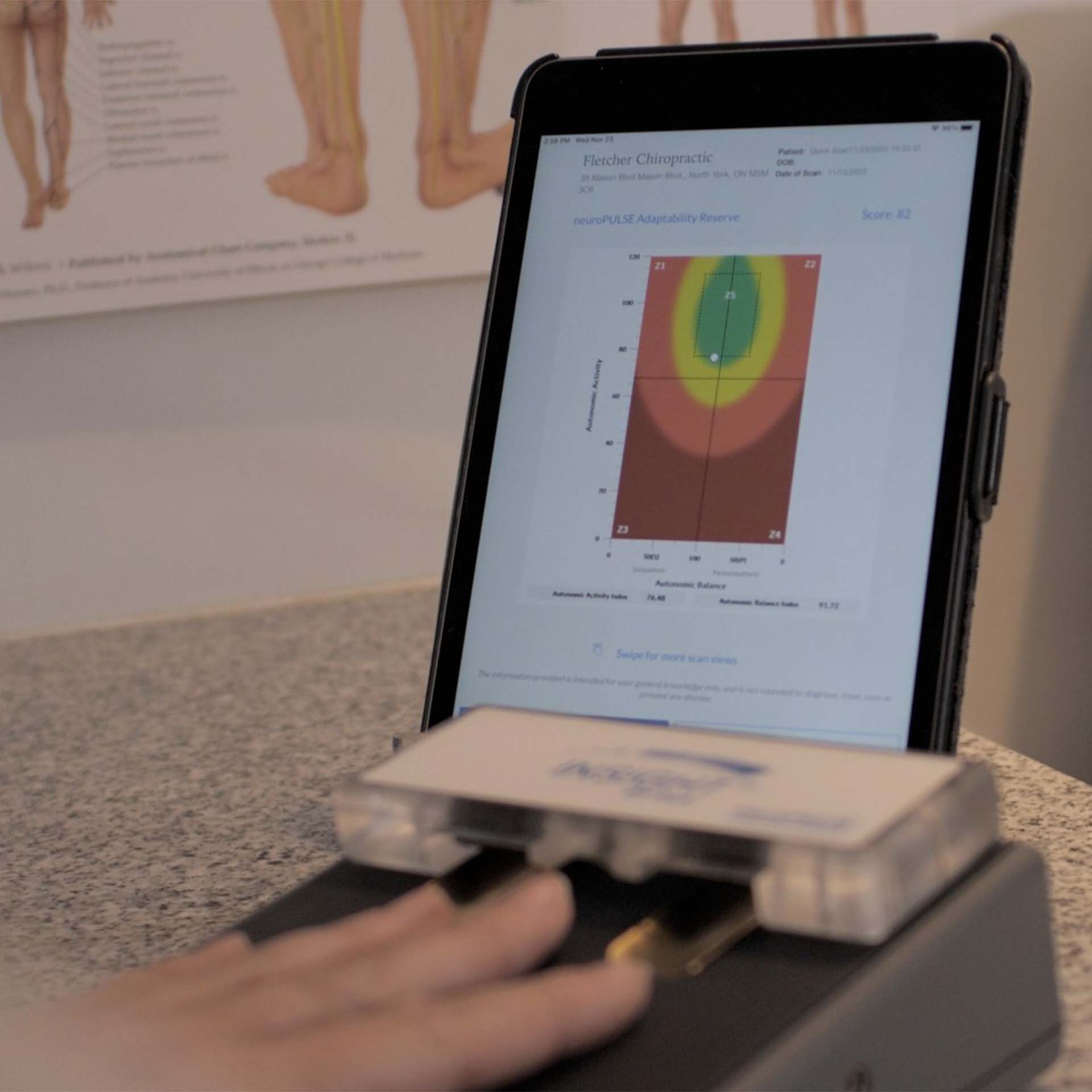 INSiGHT neuroPULSE (HRV)